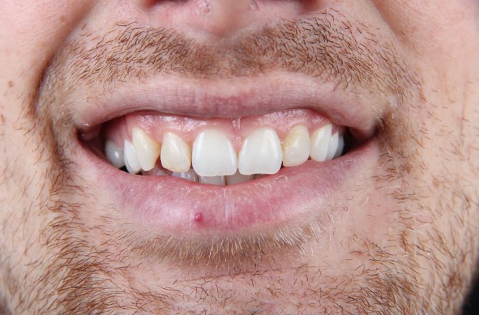 Before - Cheadle Hulme Dental