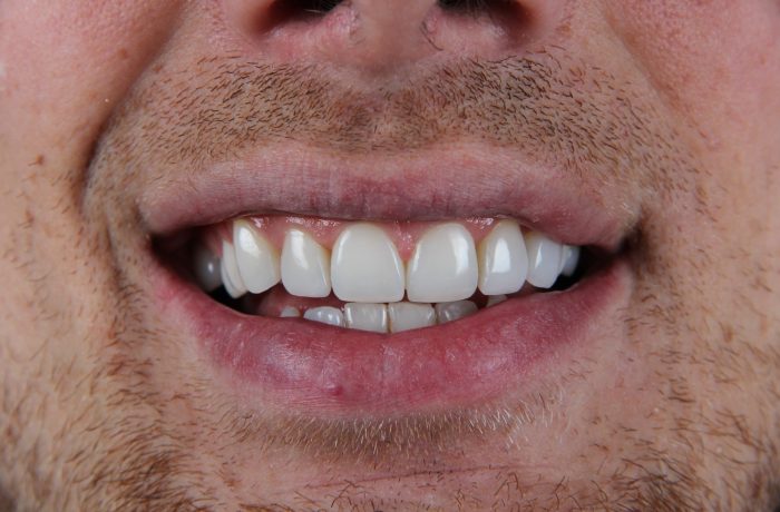 After - Cheadle Hulme Dental