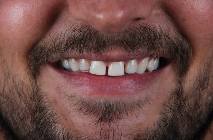 Before - Cheadle Hulme Dental
