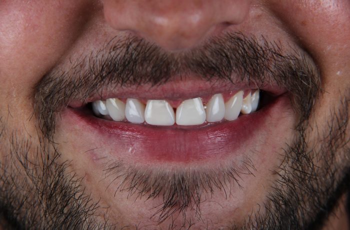 After - Cheadle Hulme Dental