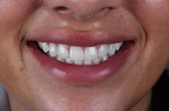 After - Cheadle Hulme Dental