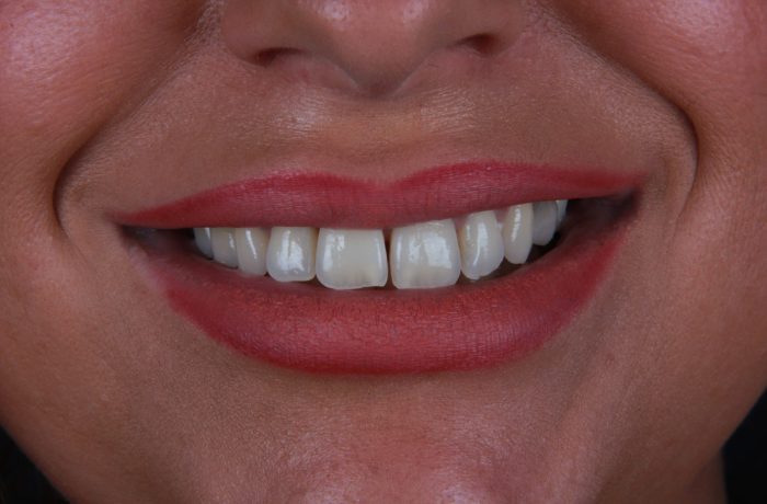 Before - Cheadle Hulme Dental