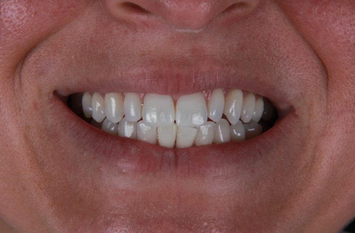 Before - Cheadle Hulme Dental