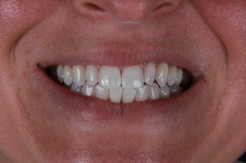 Before - Cheadle Hulme Dental