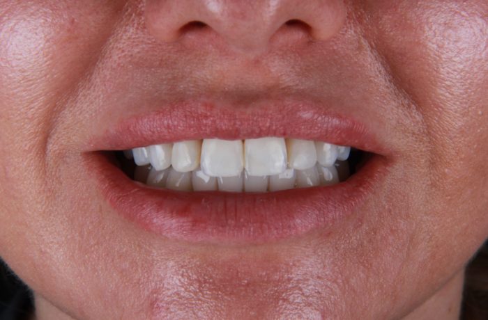 Before - Cheadle Hulme Dental