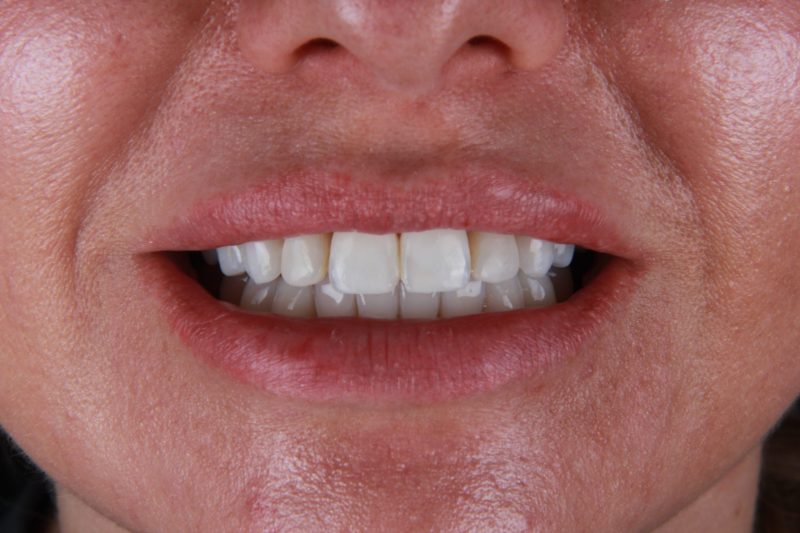 Before - Cheadle Hulme Dental