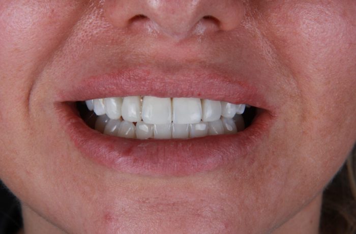 After - Cheadle Hulme Dental