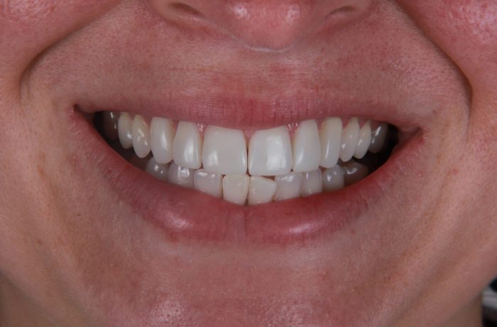 After - Cheadle Hulme Dental