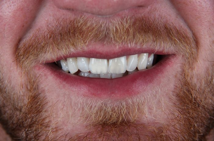 Before - Cheadle Hulme Dental