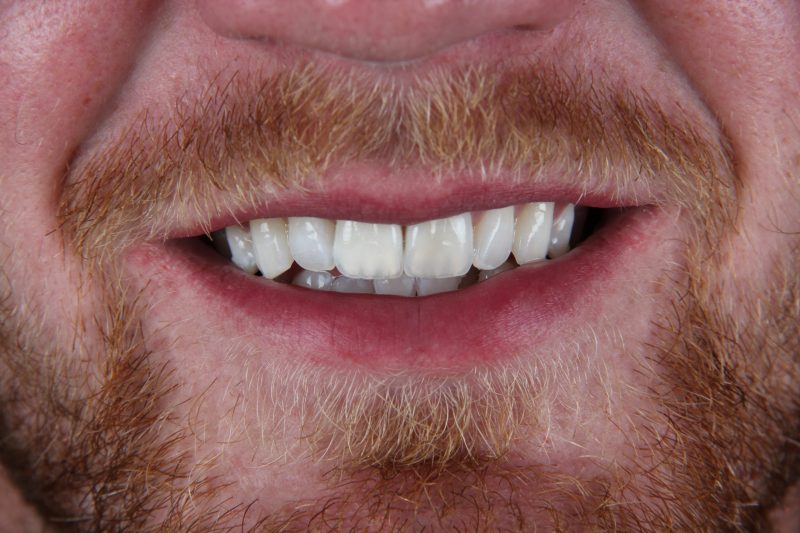 Before - Cheadle Hulme Dental