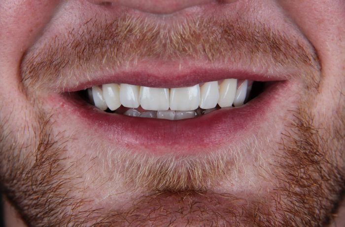 After - Cheadle Hulme Dental