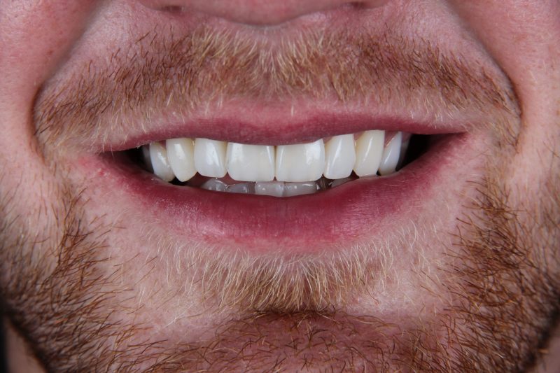 After - Cheadle Hulme Dental