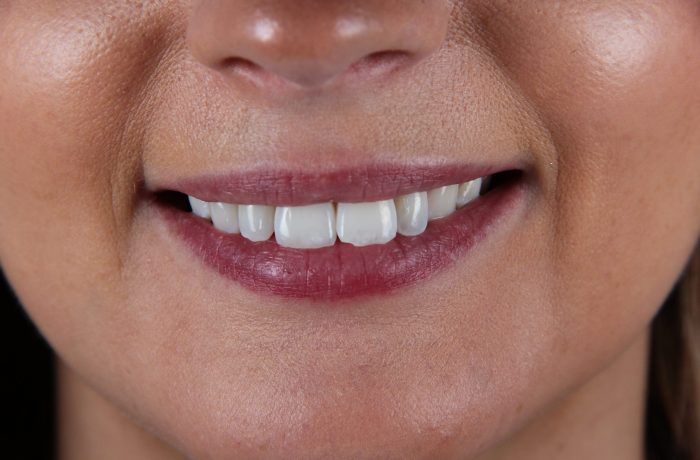 Before - Cheadle Hulme Dental