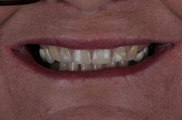 Before - Cheadle Hulme Dental