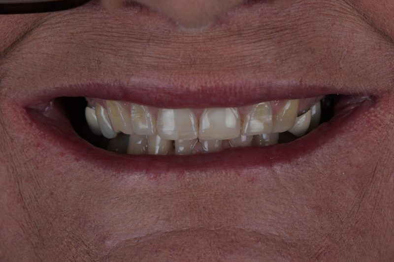 Before - Cheadlehulme Dental