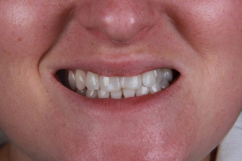 Before - Cheadlehulme Dental