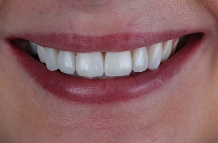 After - Cheadle Hulme Dental