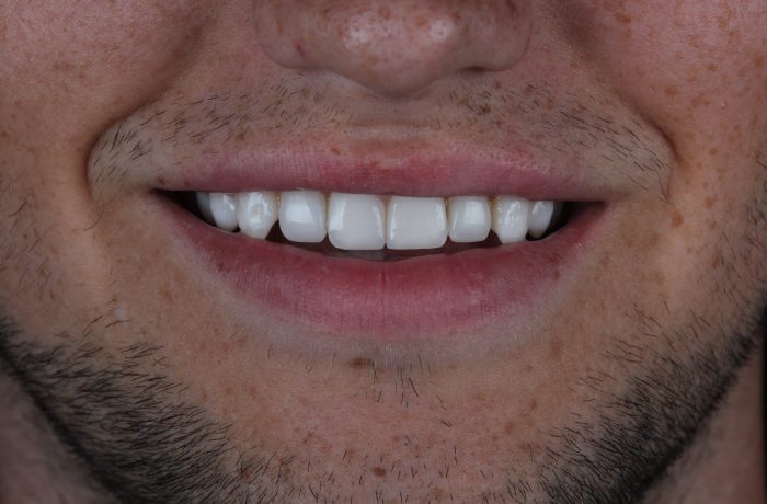 After - Cheadle Hulme Dental