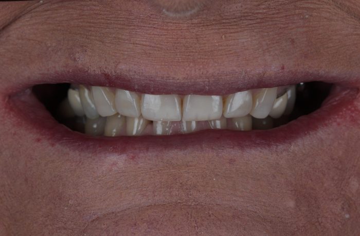 After - Cheadle Hulme Dental