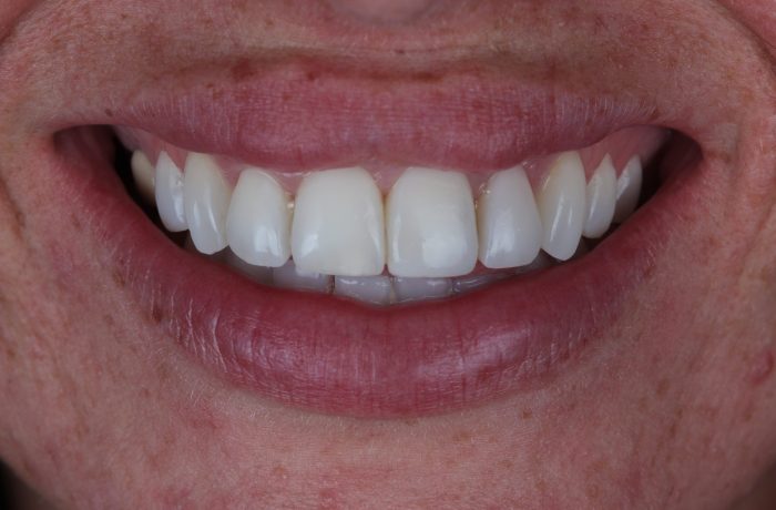 After - Cheadle Hulme Dental