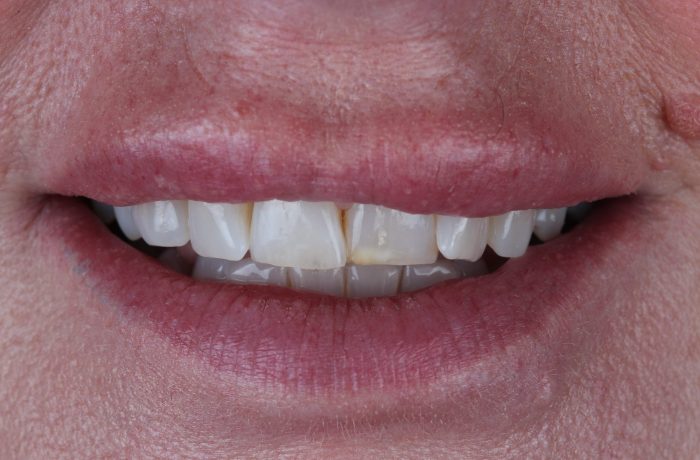 Before - Cheadle Hulme Dental