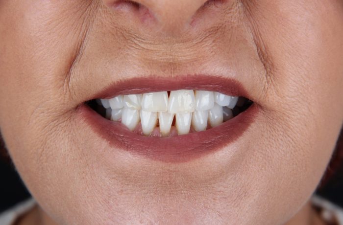 Before - Cheadle Hulme Dental