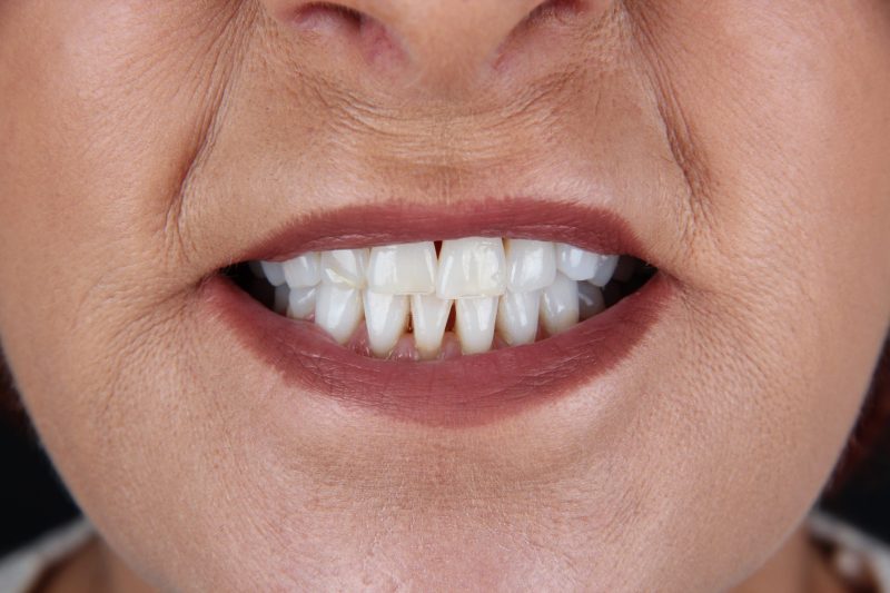 Before - Cheadle Hulme Dental