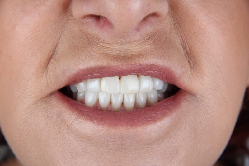 After - Cheadle Hulme Dental