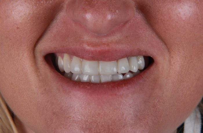 After - Cheadle Hulme Dental