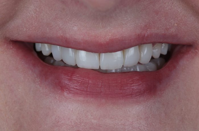 After - Cheadle Hulme Dental