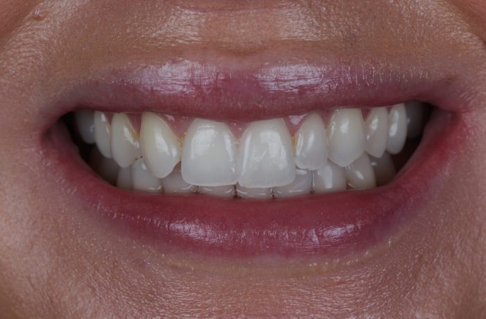 Before - Cheadle Hulme Dental