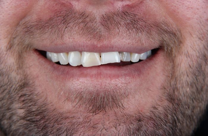 Before - Cheadle Hulme Dental