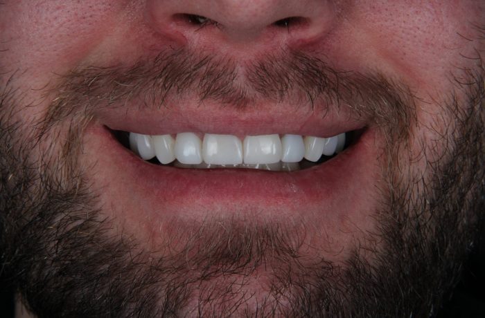 After - Cheadle Hulme Dental