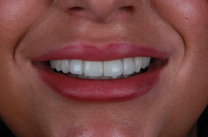 After - Cheadle Hulme Dental