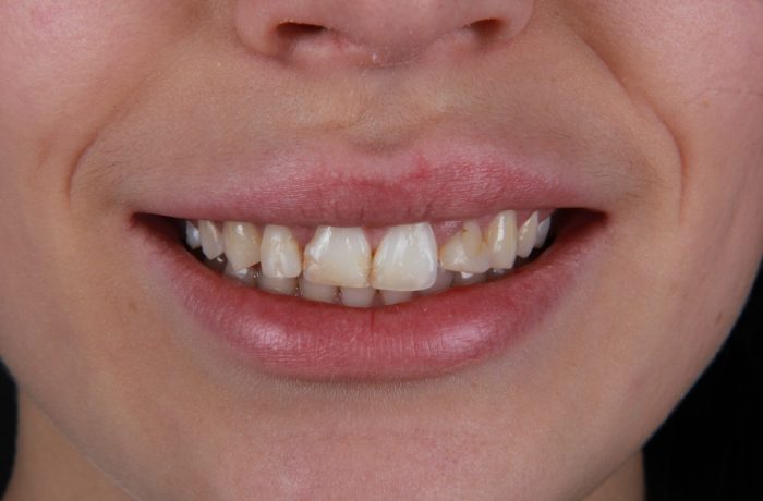 Before - Cheadle Hulme Dental