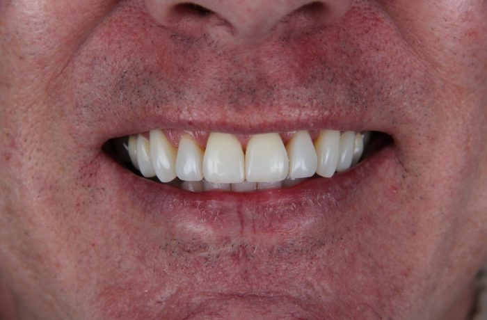 After - Cheadle Hulme Dental