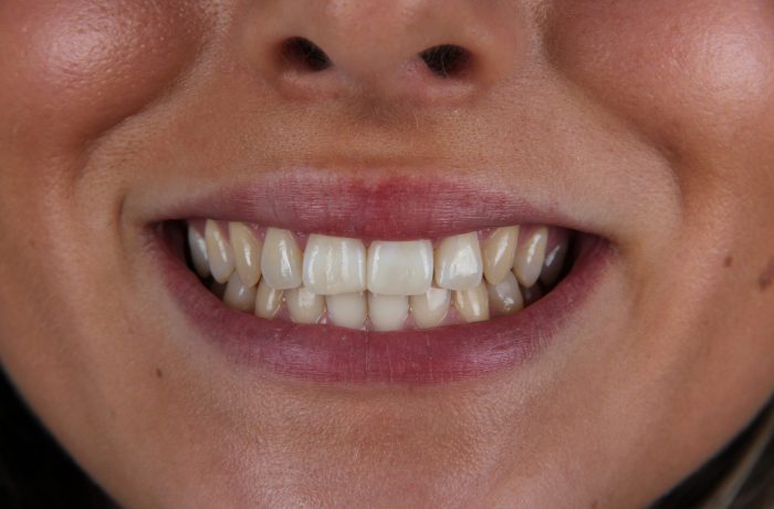 Before - Cheadle Hulme Dental