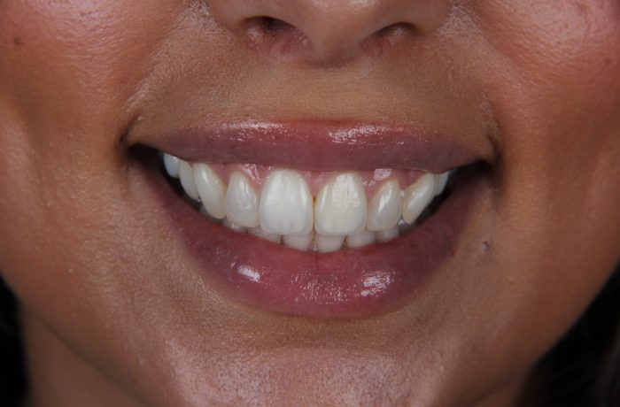 Before - Cheadle Hulme Dental
