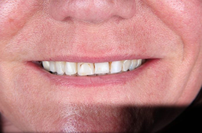 Before - Cheadle Hulme Dental