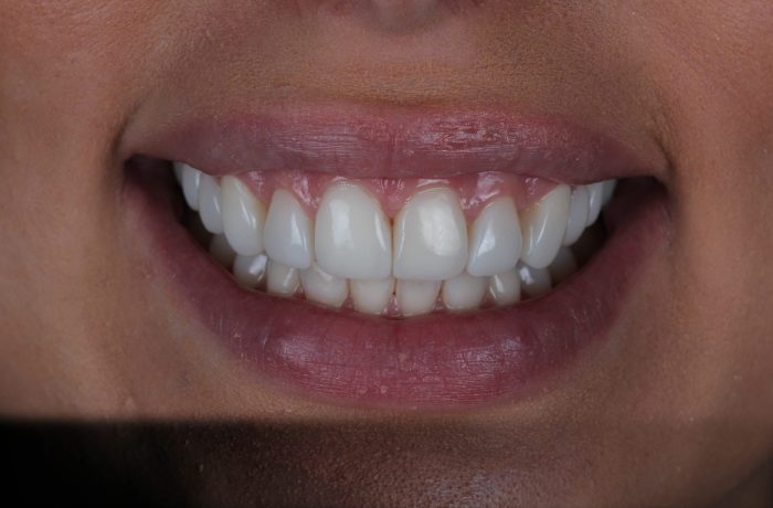 After - Cheadle Hulme Dental