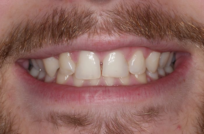 Before - Cheadle Hulme Dental
