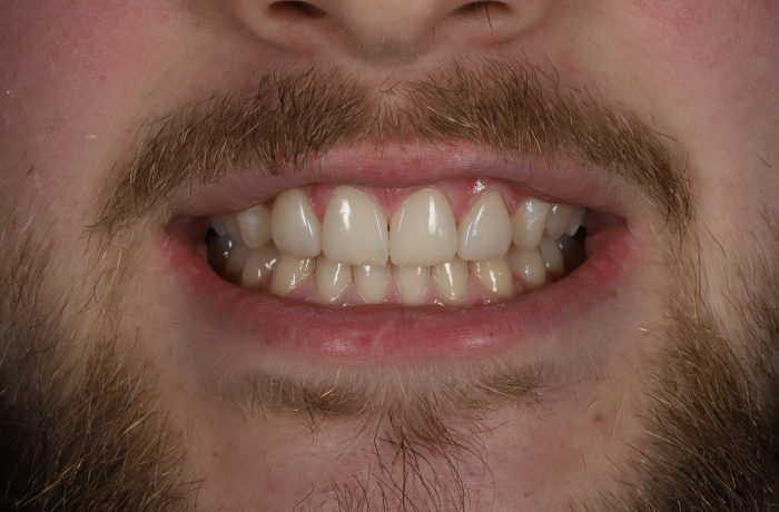 After - Cheadle Hulme Dental