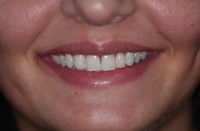 Before - Cheadle Hulme Dental