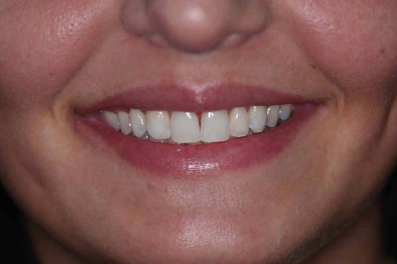 Before - Cheadle Hulme Dental