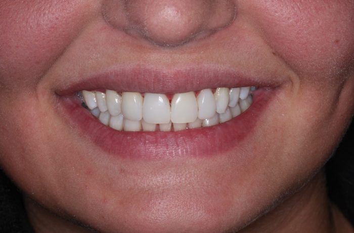 After - Cheadle Hulme Dental