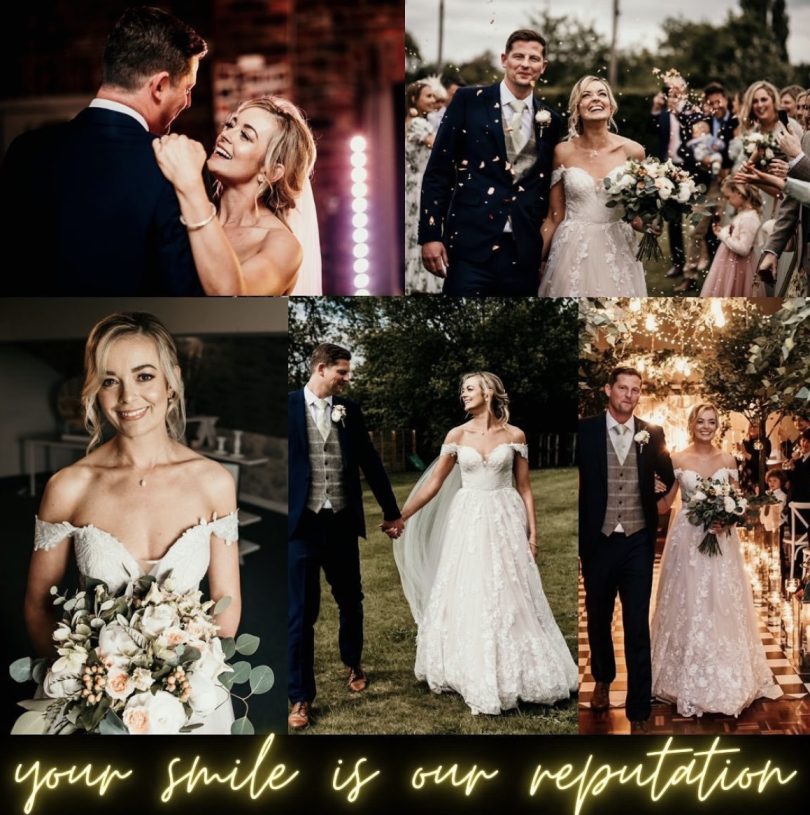 wedding smile makeover in manchester