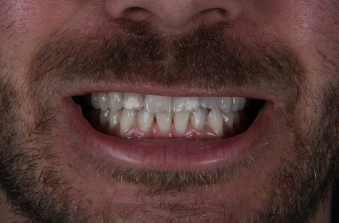Before - Cheadle Hulme Dental