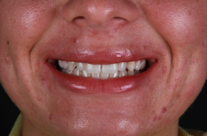 Before - Cheadle Hulme Dental
