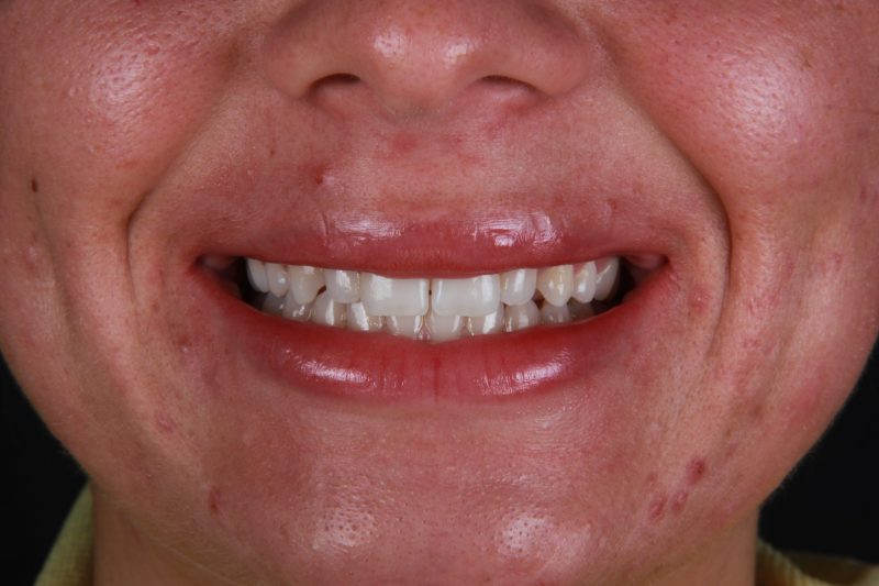IMG_8653 Before - Cheadle Hulme Dental