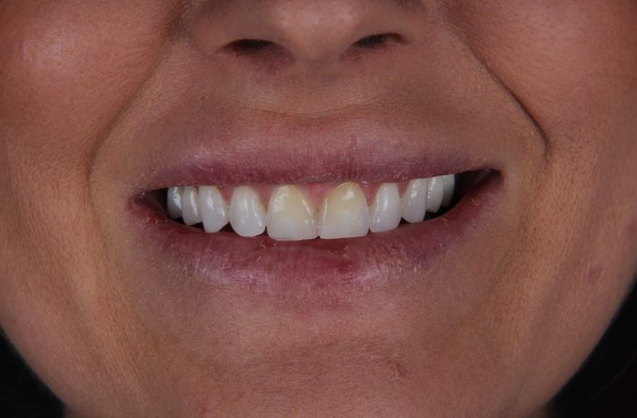 Before - Cheadle Hulme Dental
